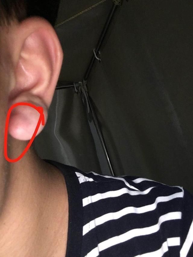 耳朵大有福|宝宝身上这四个部位越大越“有福”,长大之后有差距,对照一下吧