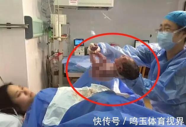 产妇|产妇生完双胞胎,突然大喊“等一下”!医生检查后发现有惊喜
