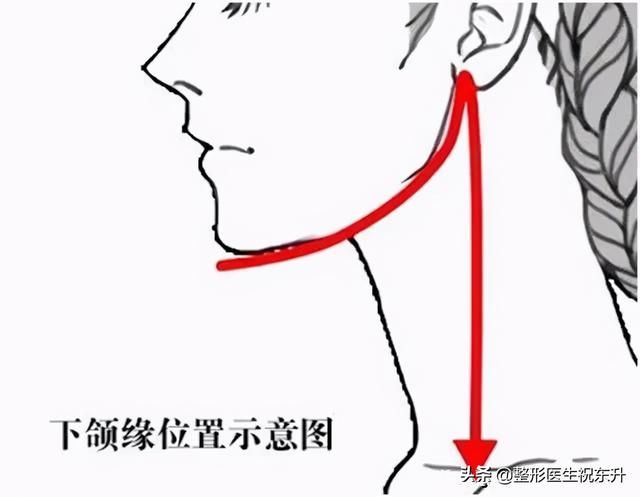 怎么提升侧颜的高级感？医生来支招：找回消失的下颌线