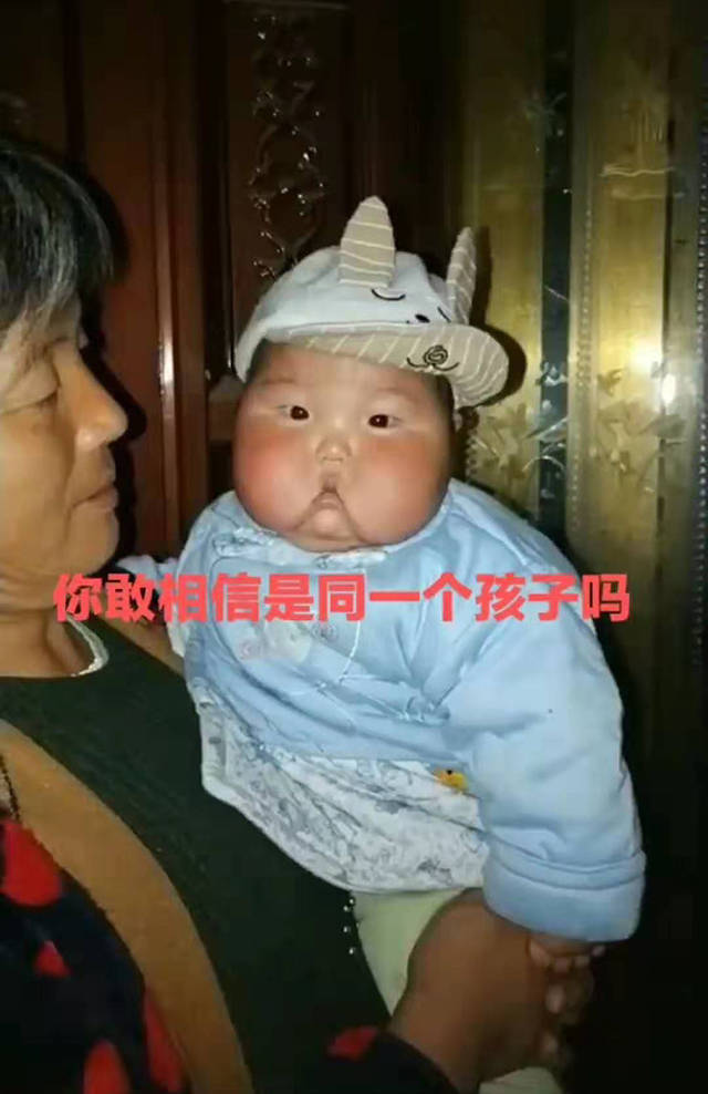 过度肥胖|奶奶带宝宝，妈妈“强行”接走，半年后宝宝大变样