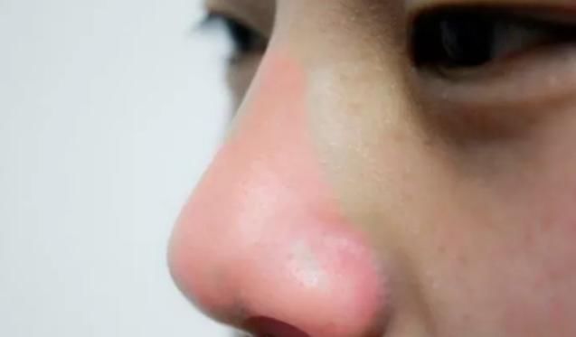 好看|初中女生别嫌鼻子不好看,3招变成好看“艺术鼻”,校花嫉妒使我丑陋