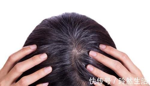 樱桃粉 发会不会致癌?染发频率多久一次合适?3个建议不妨看看