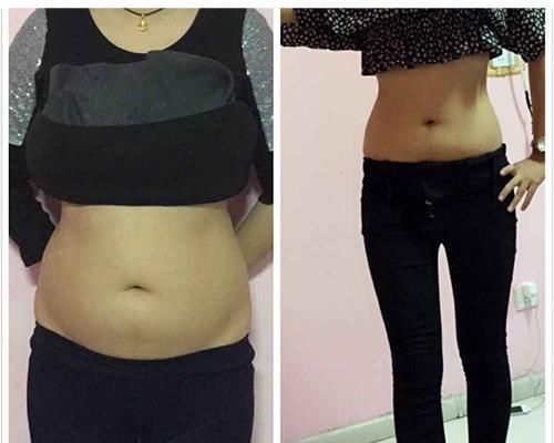 睡眠时间|42岁护士长瘦身到无一丝赘肉，大方晒出减肥方法，直言没大量运动