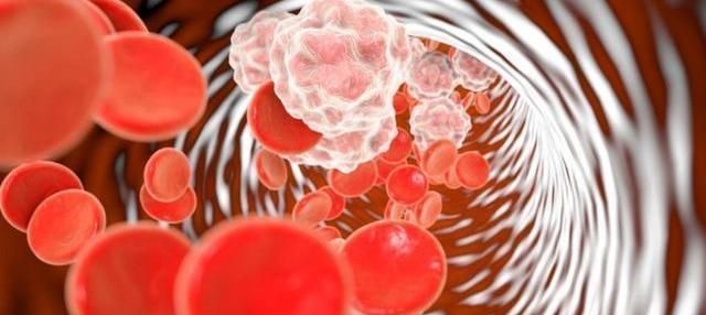 清理|山楂和它是“绝配”,连喝一周,清理血管,还你一个干净身体