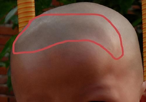 liu|宝宝卤门护理有多重要？如果出现这些情况，要尽快带娃去医院