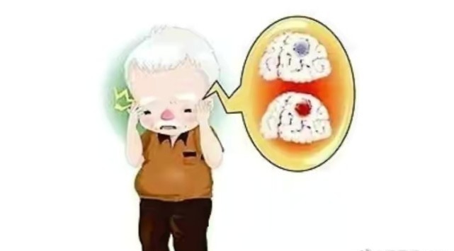 头晕头痛|中老年人脑供血不足反应