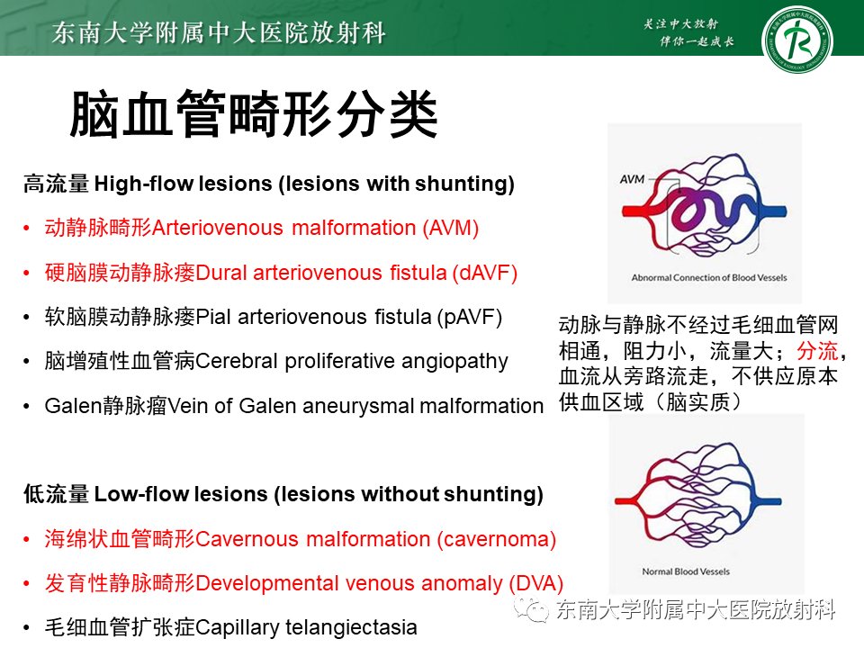 影像学|脑动静脉畸形影像学特征