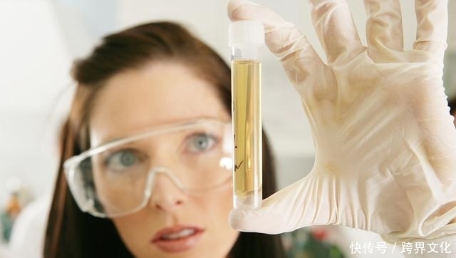 尿酸过高,上厕所时会出现3种表现,若占其中之一,最好检查肾脏