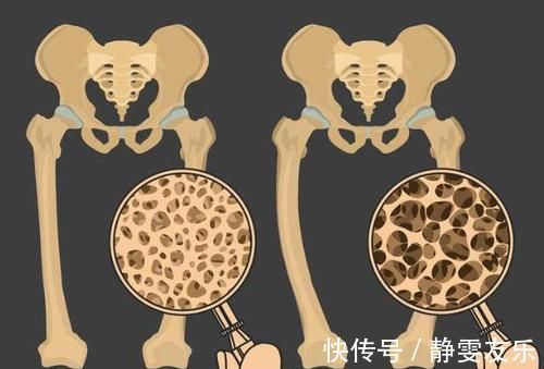 紫菜|中老年人补钙，别再依赖大骨汤了，这六物敞开吃，骨质酥松不易犯
