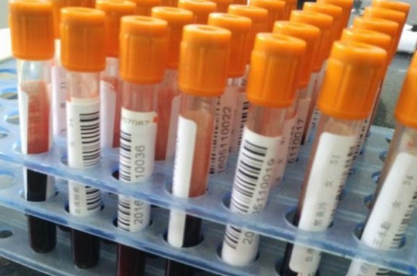 A型B型AB型O型,哪种血型更容易得病你是哪种血型