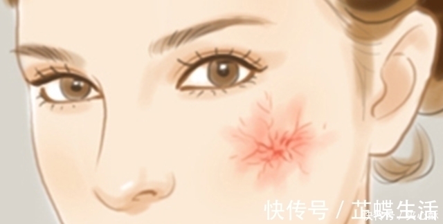 小红痣|脂肪肝加重,会有3个“不同”,常喝2种“养肝水”,肝炎都绕道