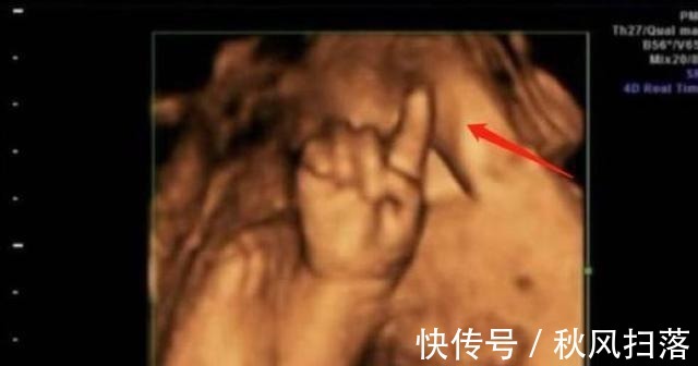 算数|“天才”胎儿走红,还在妈妈肚里就会“算数”,医生清华北大等你