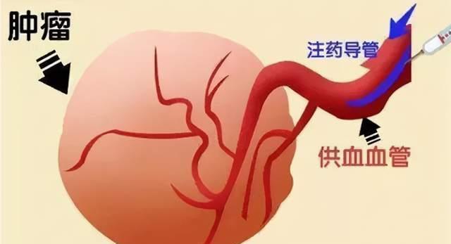 Uae是什么意思