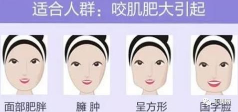 方形|咬肌肥大,一张国字脸,小姐姐用了它,方形脸变成了巴掌脸