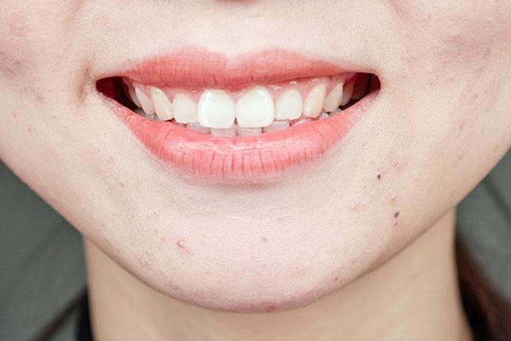 女性|女人有妇科病，嘴巴常会有几种表现暗示你，希望你一个都没有