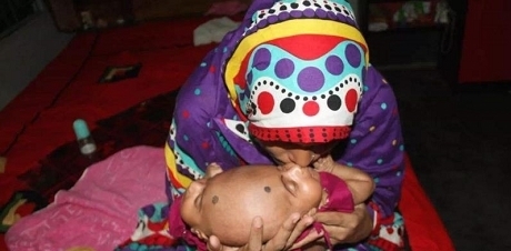 连体婴儿|印度妇女生下连体婴儿,无钱救治,送回老家,现如今让人羡慕