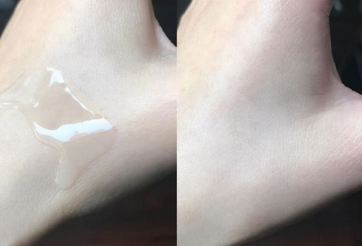 精华液|这几种“买得起”的精华液，别嫌弃是小牌子，它能替代大牌又省钱