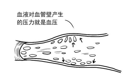 高血压|得了高血压，就一定要终身服药吗？