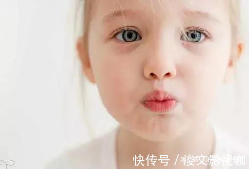 儿童|儿童牙齿矫正的黄金时期,家长们不要错过了!