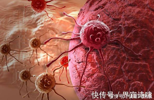 中老年人|癌症是什么病,为什么扩散的速度那么快?若想预防,3点很重要
