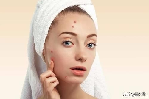 鼻子上挤出来的白色的，粘稠的丝状物，到底是啥东西？