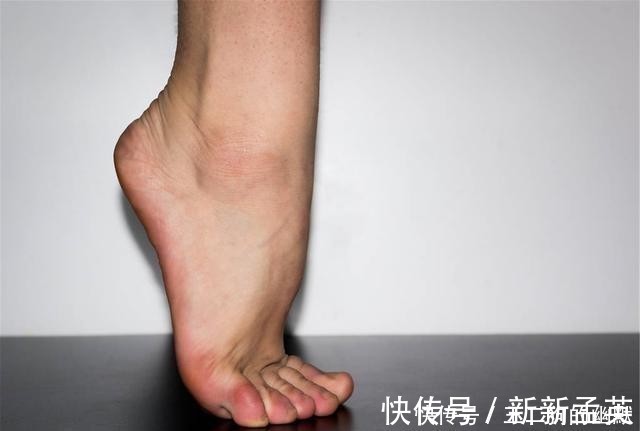 小知识|对半月板损伤后有疑惑?给你科普两个小知识,弥补你的知识空缺