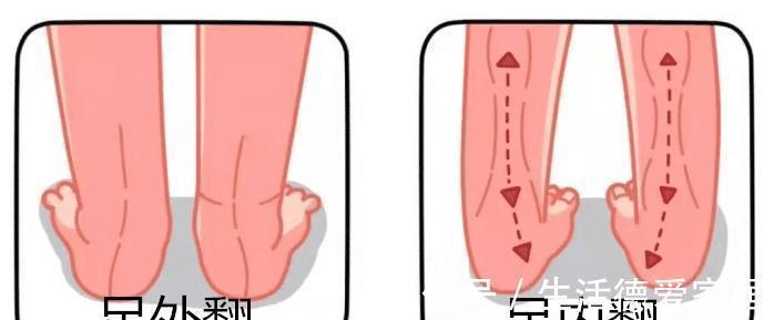 鞋头|小鞋子,大学问,如何给宝宝挑选一双合适的鞋子?