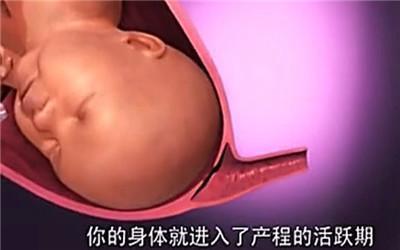 胎头那么大，到底是怎样从那么小的口出来顺产分娩全过程-附图