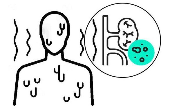 肝肾综合征|得了肝病要早点治,别拖出6个并发症,身体或承受不了