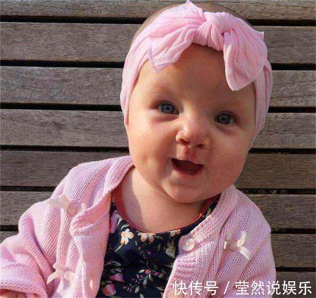 宝宝|24岁宝妈生下“兔子宝宝”,丈夫劝她放弃,手术后妈妈掩面而泣