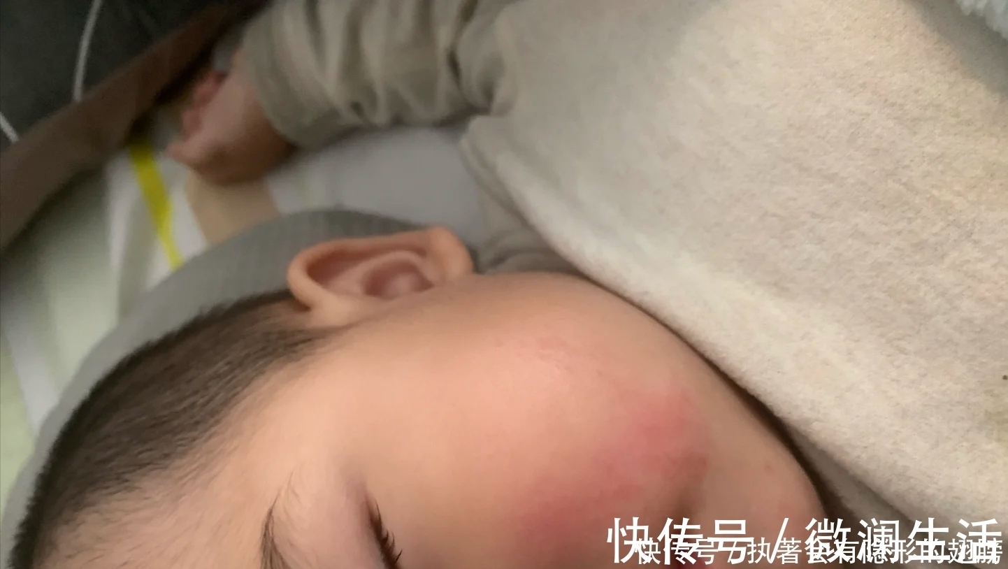 柳果刺锌|儿科主任:1种食物敞开吃,纯天然消积健脾,宝宝少积食、胃口好!