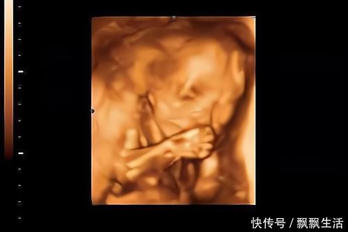 淘气|胎儿性格隔着肚皮能看出来吗？孕期欢脱的胎儿，出生后也多调皮