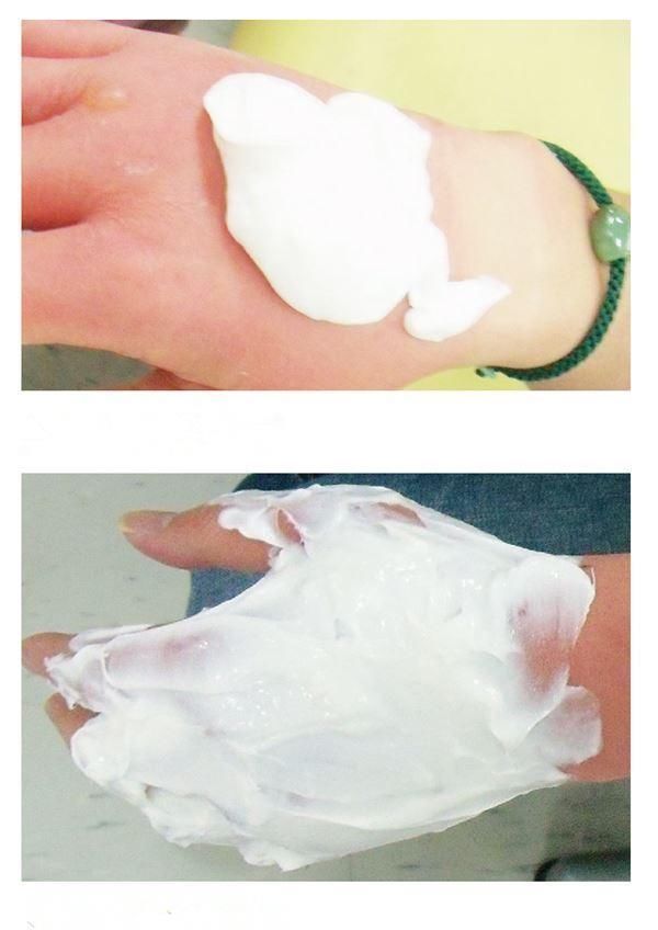 水泡|孩子烫伤后在家必做4步骤,别做4件事,照顾轻度烫伤注意5事项