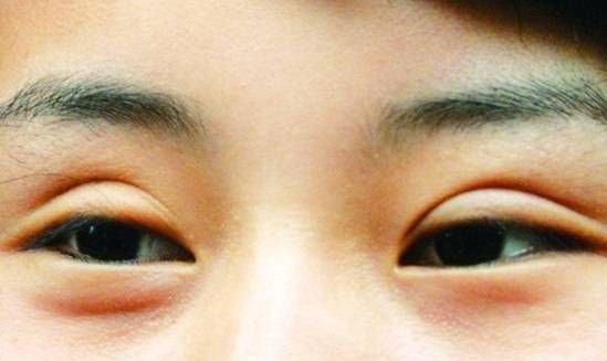 有这3种眼型的女生,基本与女神颜值无缘了,很多人都是第1种