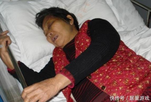 脑出血|脑溢血并不是突如其来,6个症状反复出现,就是事先已通知你了!