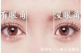 内眦赘皮 开眼角手术怎么做才能不留疤隆鼻能改善眼角吗!