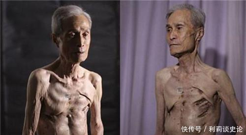 制造|广岛核爆后的幸存者,面对采访哭诉:人类别再制造我这样的怪物了