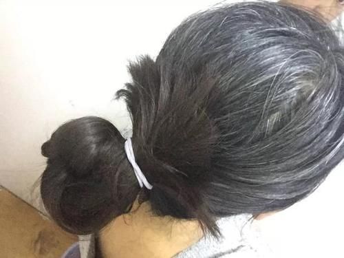 营养|如果女性白头发增多,不要总认为老了,或是因为体内缺乏3种营养