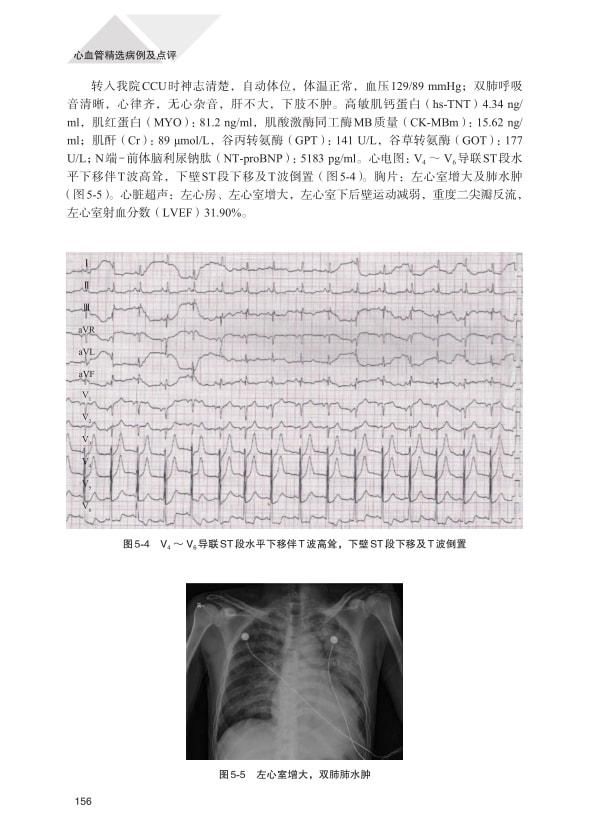 点评|凝聚经验和心血：《心血管精选病例及点评》