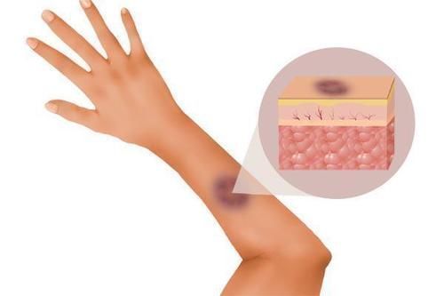 脾脏|十人九脾虚脾虚命薄,老祖宗留下的健脾妙方,补虚养脾全身轻松