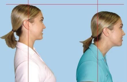 颈椎病|颈椎病的元凶找到了，教您2个方法，可以快速缓解颈椎疼痛