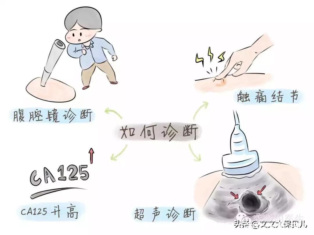 核保|核保实例:真皮间叶源性梭形细胞肿瘤术后、重疾险标准体承保