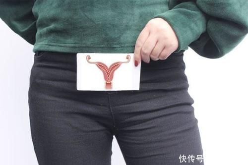 节育环|很多女性“上环”后很后悔,为何?原来对身体有五个危害,望重视