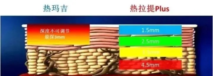 热拉提和热玛吉哪个好?这篇给你搞明白!丨温习篇