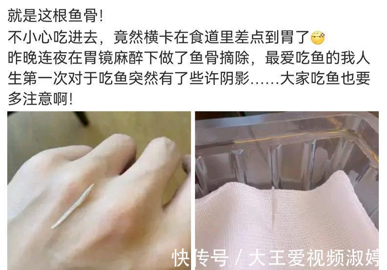 逆天改命|张杰被3cm鱼刺卡喉,他做了一件最正确的事,值得妈妈们学习!
