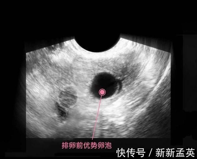 胚胎|胎儿从卵泡到性别形成,17张图片清晰诠释,男宝女宝看得很清楚