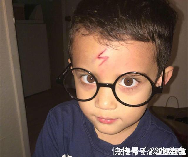 宝妈|男孩不小心磕破了额头,宝妈灵机一动,让娃变成了“哈利波特”
