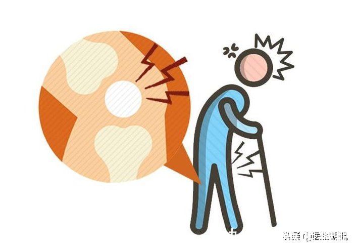 副作用|血压高，长期服用降压药，3个副作用在所难免，做好4点可缓解