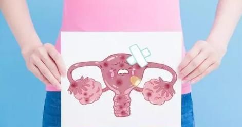  妇女|女性常做5事，真的会很伤“子宫”！平时做到4点可好好保护