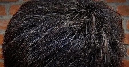 桑椹酒|天然的“染发剂”被找到了，坚持每天吃一点，白发悄悄变黑发